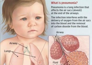 Mystery disease in China raises global concern