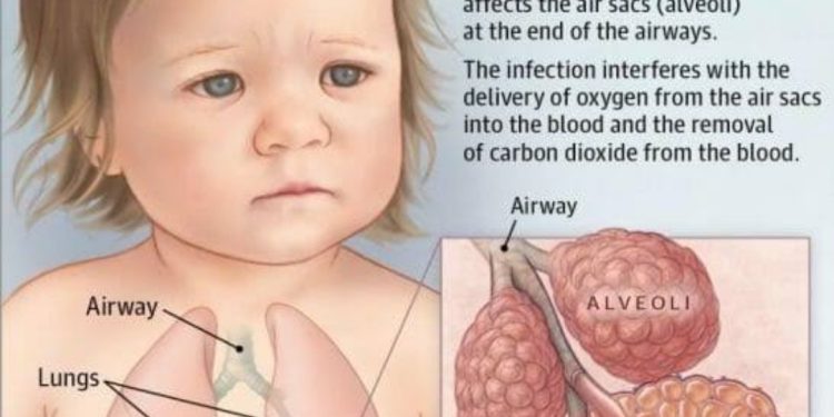 Mystery disease in China raises global concern