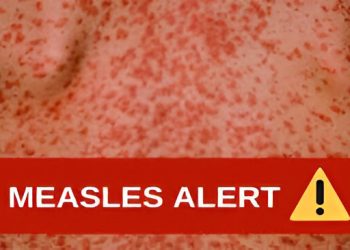 Health authority issues measles alert in Australia’s New South Wales