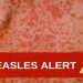 Health authority issues measles alert in Australia’s New South Wales