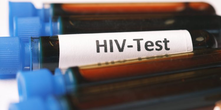 UN commends Nigeria’s progress in tackling HIV