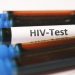 UN commends Nigeria’s progress in tackling HIV