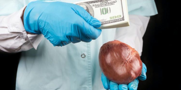 NAPTIP arraigns MD Alliance Hospital, three others for organ harvesting 