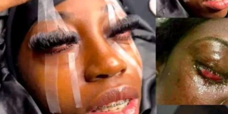Fashion nightmare: Lady goes blind after undergoing eyelash extension