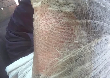 Bus driver sets self, LASTMA officer ablaze to evade arrest