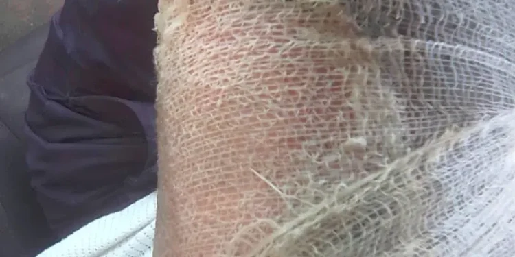 Bus driver sets self, LASTMA officer ablaze to evade arrest