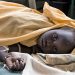 A South Sudan child suffering from Cholera. [PHOTO CREDIT: CIDRAP]