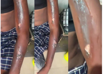 Police probe torture of teenager by teachers