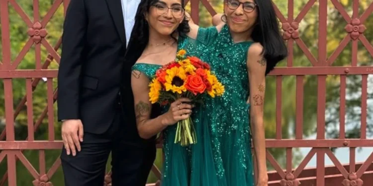 Conjoined Twins, Carmen and Lupita Andrade