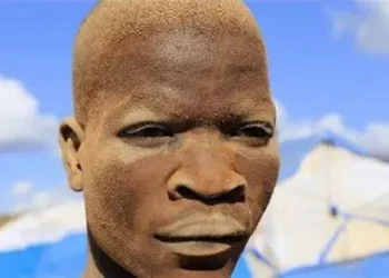 Doctor advises prompt skin care as harmattan arrives