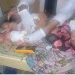 Woman dies hours after birth of quintuplets