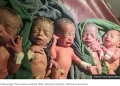 The quintuplets