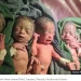 The quintuplets
