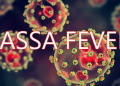 Lassa Fever