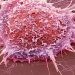 Microscopic view of cancer cells linked to infection-related cancer research.