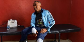 Omoyele Sowore with bandages following an incident in Ado-Ekiti.